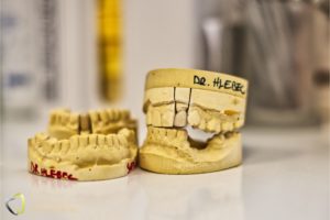 zubna protetika
